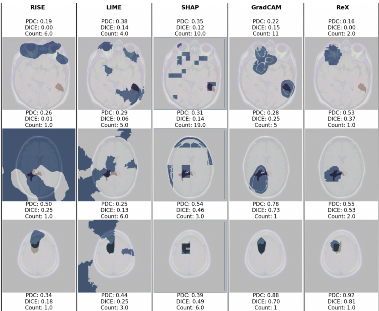 Comparision of different explainability tools